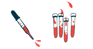 An eyedropper hovers next to four vials, all partially filled with red liquid.