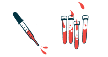 An eyedropper hovers next to four vials, all partially filled with red liquid.
