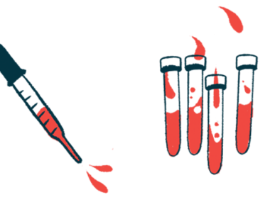 An eyedropper hovers next to four vials, all partially filled with red liquid.