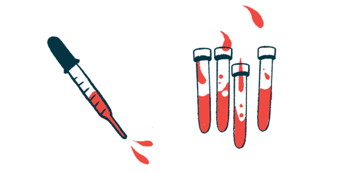 An eyedropper hovers next to four vials, all partially filled with red liquid.