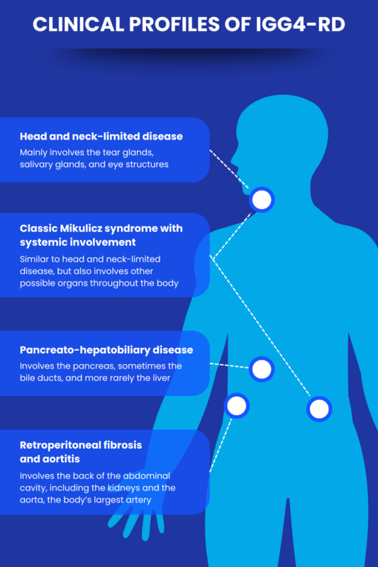 Clinical profiles of IgG4-RD