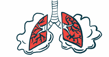 An illustration provides a close-up view of the human windpipe between two lungs, which are surrounded by clouds.