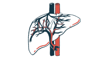 llustration of the liver showing the branching bile ducts that carry bile from the liver to the digestive system.