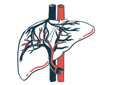 llustration of the liver showing the branching bile ducts that carry bile from the liver to the digestive system.